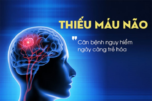 Làm thế nào để hạn chế nguy cơ, biến chứng do cơn thiếu máu não thoáng qua?