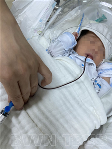 Xuất huyết tiêu hoá ở trẻ sơ sinh: Không nên chủ quan