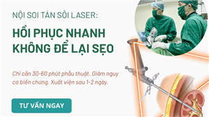 Công nghệ tán sỏi hiện đại, không đau, hồi phục nhanh