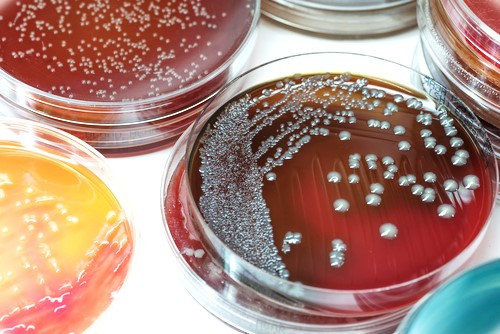 Xét nghiệm nuôi cấy và định danh vi khuẩn là gì?