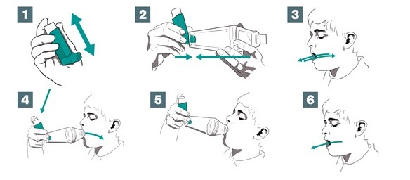 Cách sử dụng bình xịt hen suyễn đúng cách như thế nào?
