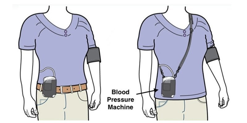 Holter huyết áp là thiết bị gì và chức năng của nó là gì?
