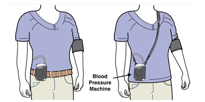 Tại sao nên sử dụng Holter huyết áp?
