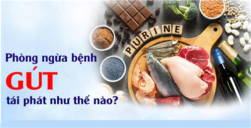 Phòng ngừa bệnh gút tái phát như thế nào?