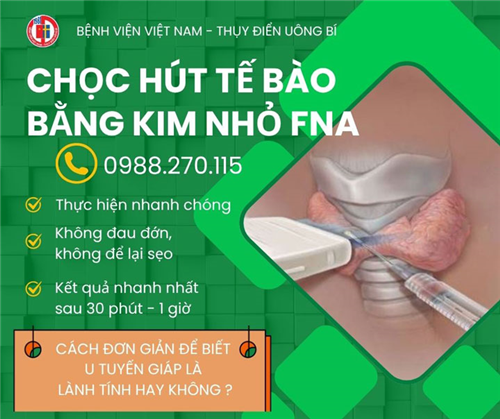 Cách đơn giản để biết u tuyến giáp lành tính hay ác tính