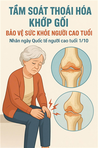 Nhân ngày Quốc tế người cao tuổi 1/10: Tầm soát thoái hóa khớp gối bảo vệ sức khỏe người cao tuổi