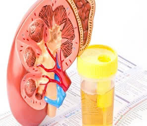 Microalbumin niệu - Xét nghiệm quan trọng để bảo vệ thận và tim mạch