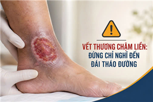 Vết thương chậm liền: Đừng chỉ nghĩ đến đái tháo đường