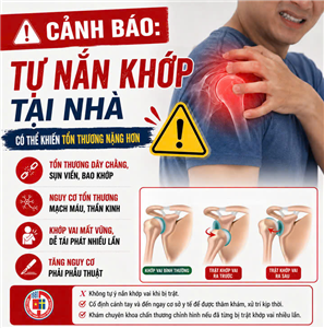 Cảnh báo: Tự nắn khớp tại nhà có thể khiến tổn thương nặng hơn