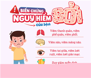 Dịch sởi bùng phát: Cảnh báo đỏ cho cộng đồng!