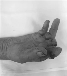 Luôn cẩn trọng trước những tai nạn sinh hoạt có thể xảy ra