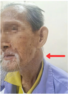 91 tuổi vẫn kiên cường chiến đấu với ung thư