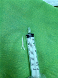 Cảnh báo nguy hiểm từ hóc xương cá