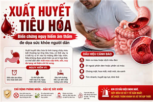 Xuất huyết tiêu hóa- Biến chứng nguy hiểm âm thầm đe dọa sức khỏe người dân