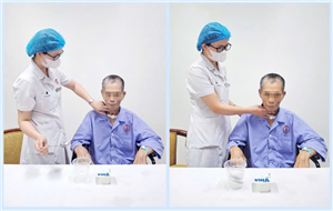 Tập nuốt – bước quan trọng giúp người bệnh đột quỵ trở lại cuộc sống bình thường